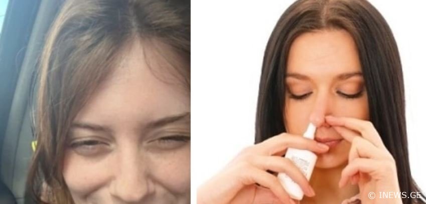 "აქამდეც უნდა მეთქვა, მაგრამ მეშინოდა... იწყება გულის, თავის ტკივილი, ტაქიკარდია…“ - ეს ინფორმაცია ყველამ უნდა ნახოს