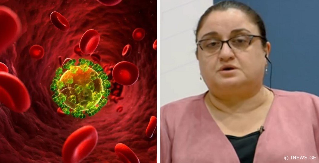 "ბევრი რუსი შემოვიდა, მაღალია აივ ინფექცია/შიდსის გავრცელება..." - რა განცხადებას აკეთებს ინფექციონისტი მაია ბუწაშვილი