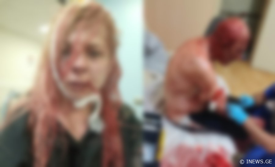 "მამას 30-ზე მეტი ჭრილობა აქვს, მე - 4. სასტიკად ნაცემი ვარ, სახლს წაუკიდა ცეცხლი, მოუშვა გაზი" - თბილისში ოჯახს თავს დაესხნენ