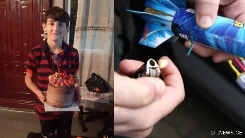 „მდგომარეობა მძიმეა, ექიმები მეორე თვალის გადარჩენას ცდილობენ“, - რა შეემთხვა 10 წლის ლაზარეს