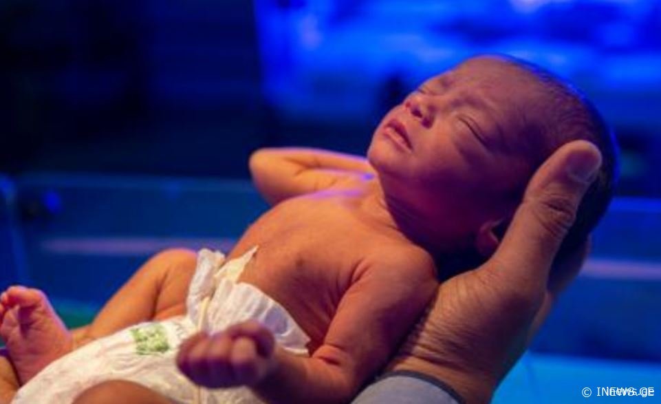 "ისრაელში დაიბადა ბავშვი, რომელსაც მუცელში ტყუპისცალი ჰყავდა.." – რა გახდა უჩვეულო მოვლენის მიზეზი
