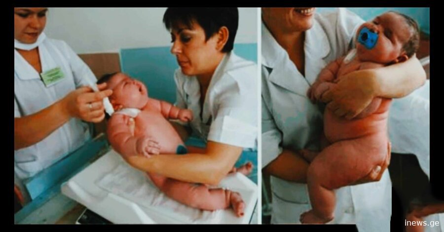 კიდევ ერთი სასწაული მედიცინაში - დაიბადა 18 კილოგრამიანი ბავშვი