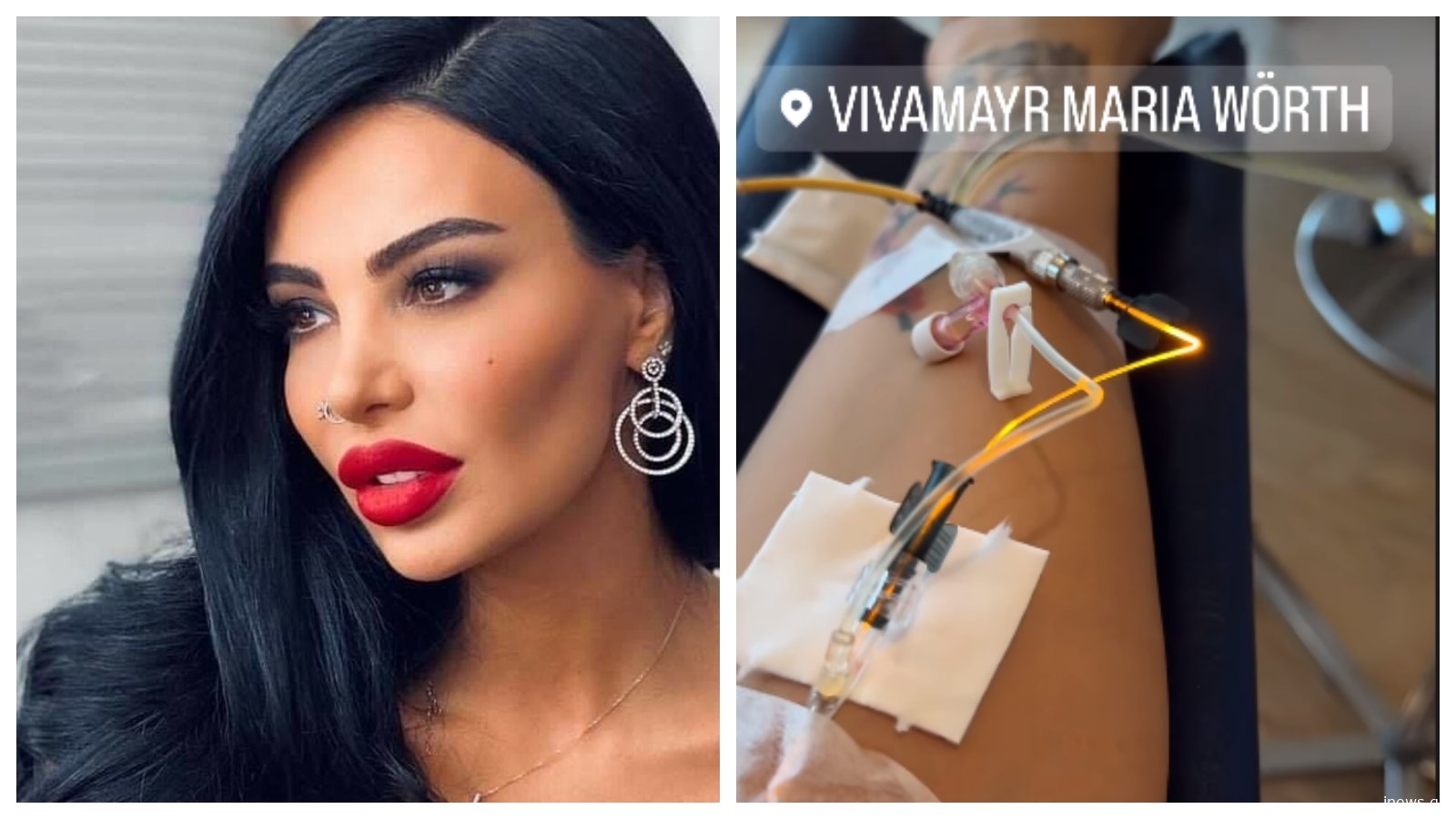 PHOTO: შორენა ბეგაშვილი კლინიკაშია - რა ფოტოებს აქვეყნებს ის სოც. ქსელში