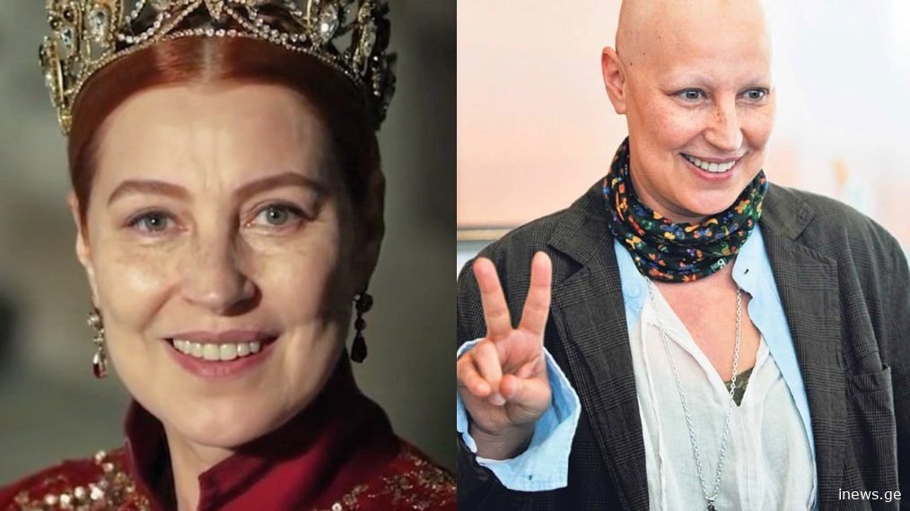 “ჩუკუროვასა” და “დიდებული საუკუნის” ვარსკვლავის რთული ცხოვრება – მძიმე სენთან ბრძოლა და სხვა ისტორიები