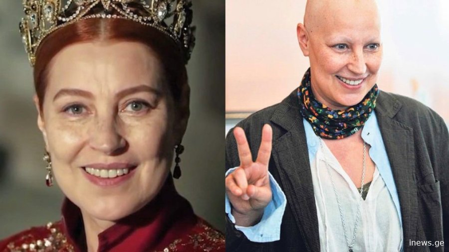 “ჩუკუროვასა” და “დიდებული საუკუნის” ვარსკვლავის რთული ცხოვრება – მძიმე სენთან ბრძოლა და სხვა ისტორიები