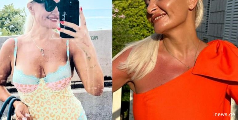 თურმე როგორი ყოფილა ნანუკა… – ნანუკა ჟორჟოლიანმა პლასტიკულ ოპერაციამდეგადაღებული ფოტოები გამოაქვეყნა და მთელი ინტერნეტი ააფეთქა