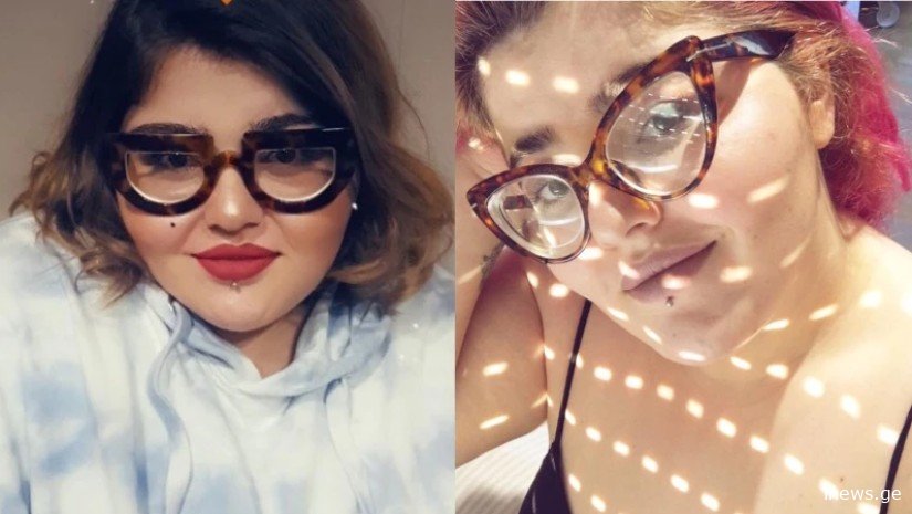 ვინ იყო 25 წლის გოგო, რომელიც უმძიმეს ავარიას ემსხვერპლა