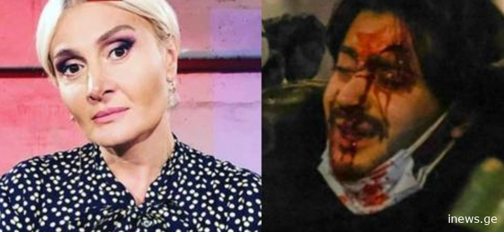 "22 წლის ალექსი თირქიას ოჯახის თხოვნას გადმოგცემთ. ბიჭის, რომელიც კომაშია ახლა" - ნანუკა ჟორჟოლიანი