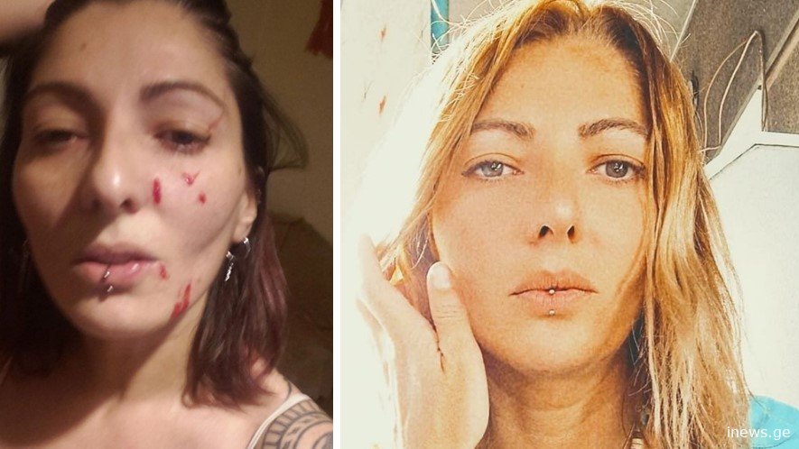 ია გაბუნია - სადარბაზოში დამხვდა 2 ტიპი და ხელჩართულ ბრძოლაში ცოტა სახე მიმიჩოხანეს