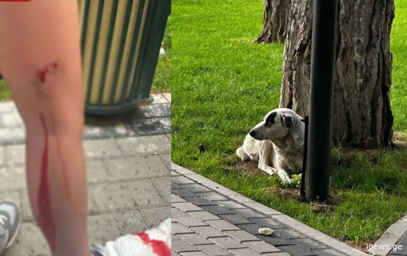 "არავინ გამოხტეს ახლა ძაღლების უფლება დამცველი, გლდანში 5 ძაღლი დაედევნა ბავშვებს და 10 წლის ბიჭს სამმა ძაღლმა უკბინა, გამოაგლიჯა ხორცები” - რას წერს მოქალაქე