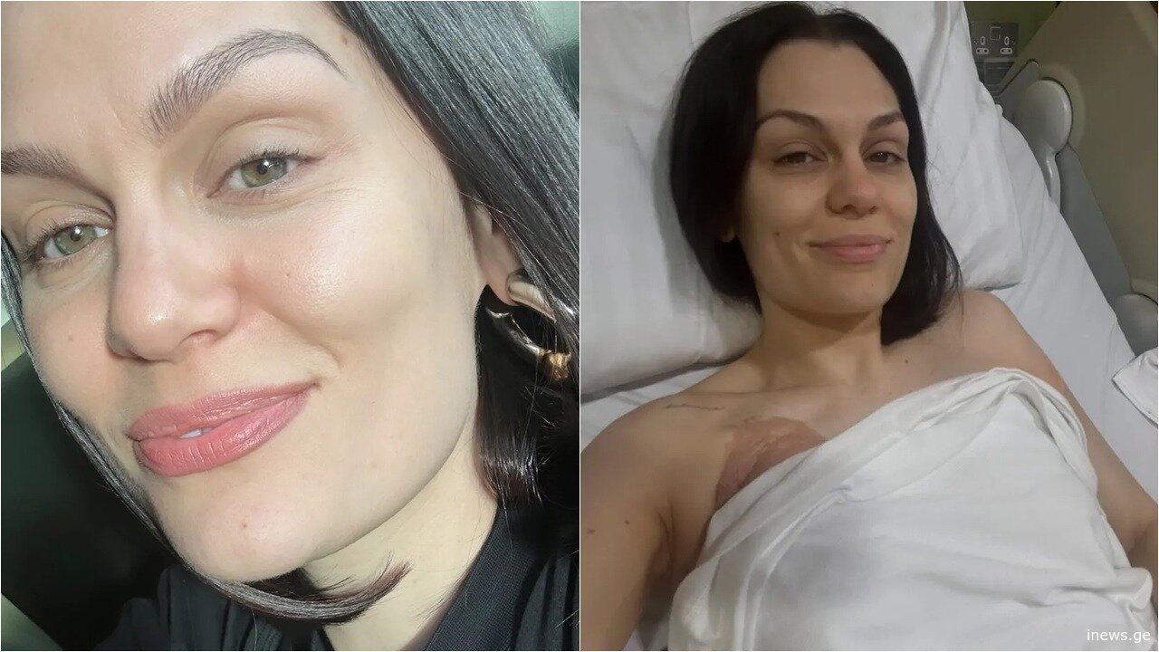 ეს სიხარულის ცრემლებია – ჯესი ჯეიმ მკერდის კიბო დაამარცხა – 35 წლის არტისტი ემოციურ ვიდეოს ავრცელებს